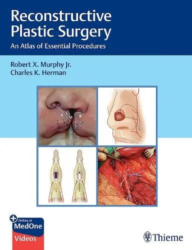 Reconstructive Plastic Surgery: An Atlas of Essent...