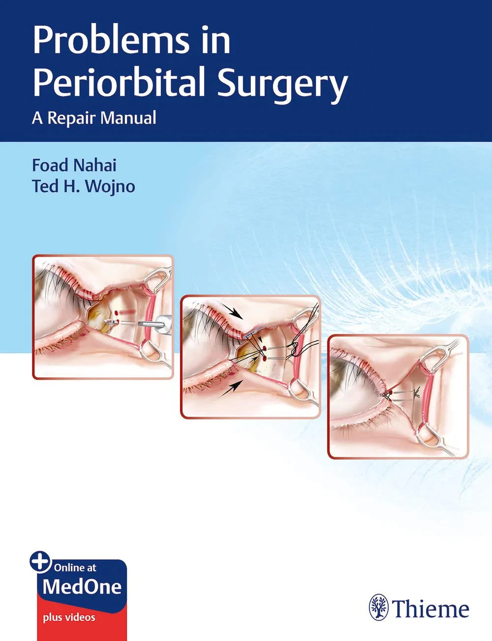 Problems in Periorbital Surgery: A Repair Manual