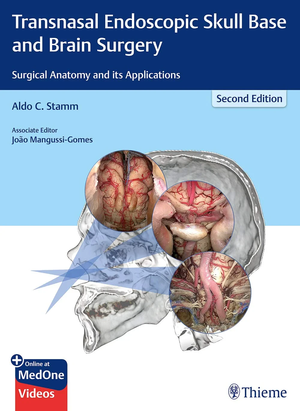 Transnasal Endoscopic Skull Base and Brain Surgery...