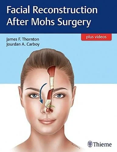 Coperta cărții "Facial Reconstruction After Mohs Surgery " de James Thornton, Jourdan Carboy