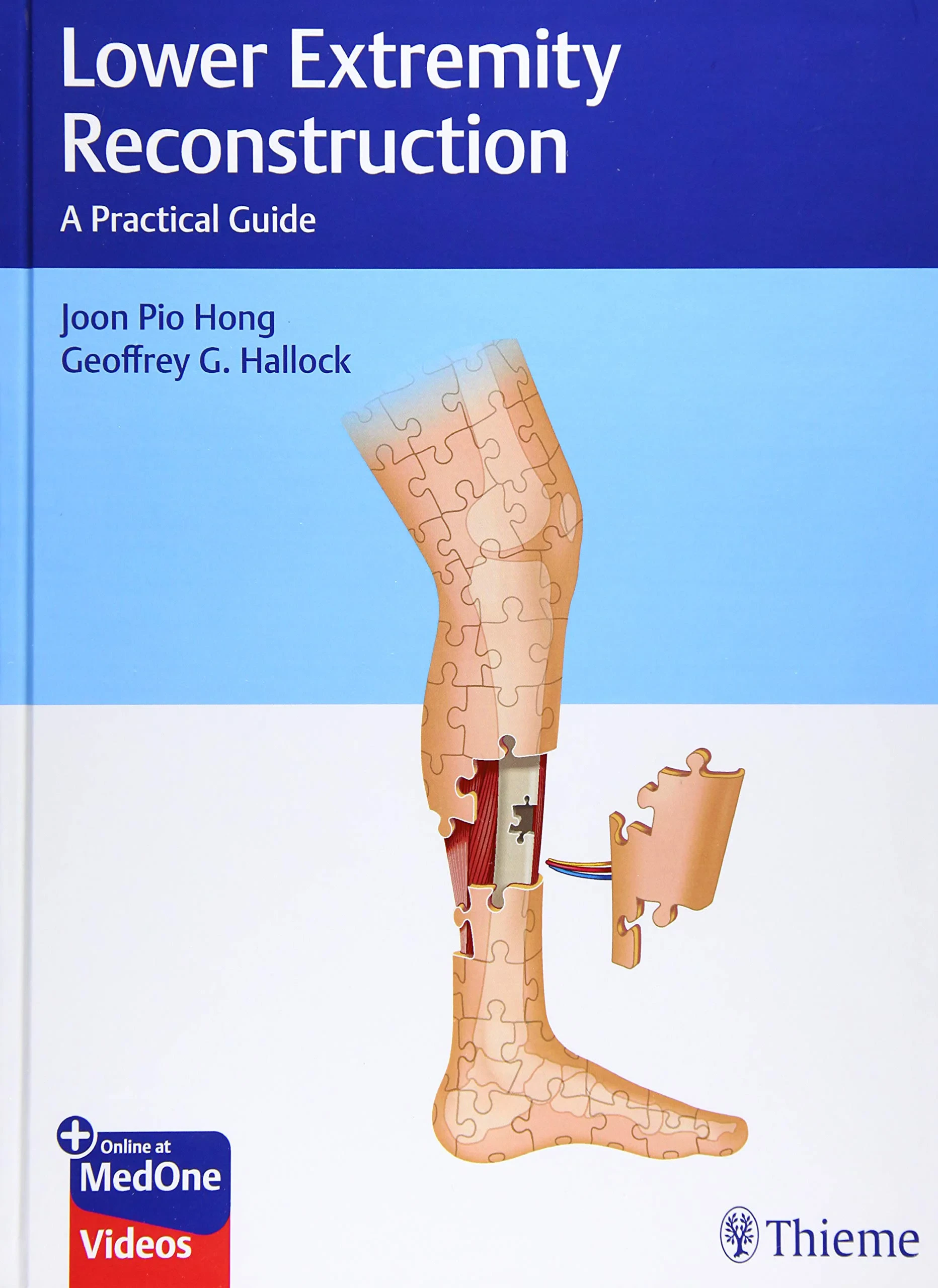 Lower Extremity Reconstruction: A Practical Guide