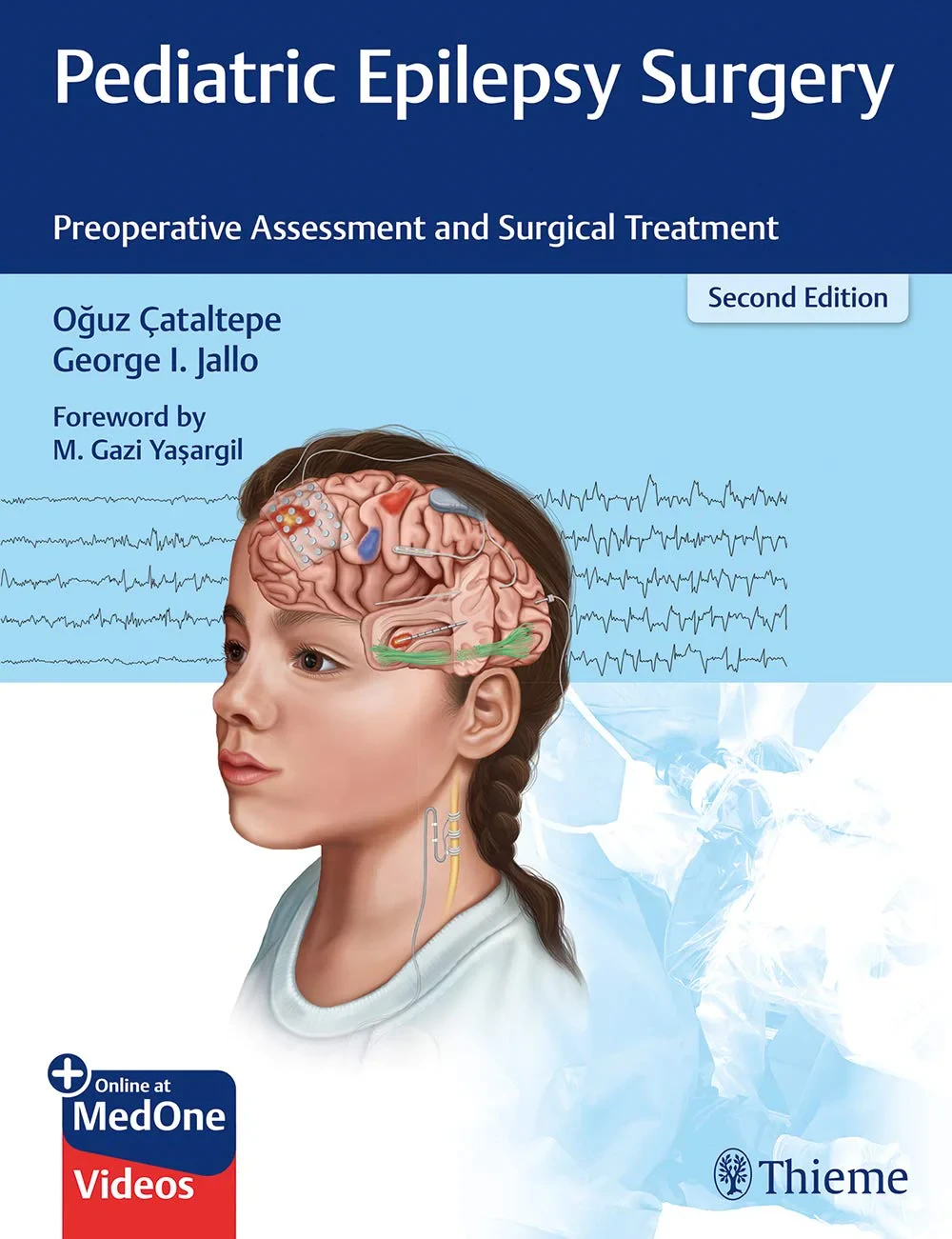 Pediatric Epilepsy Surgery: Preoperative Assessmen...