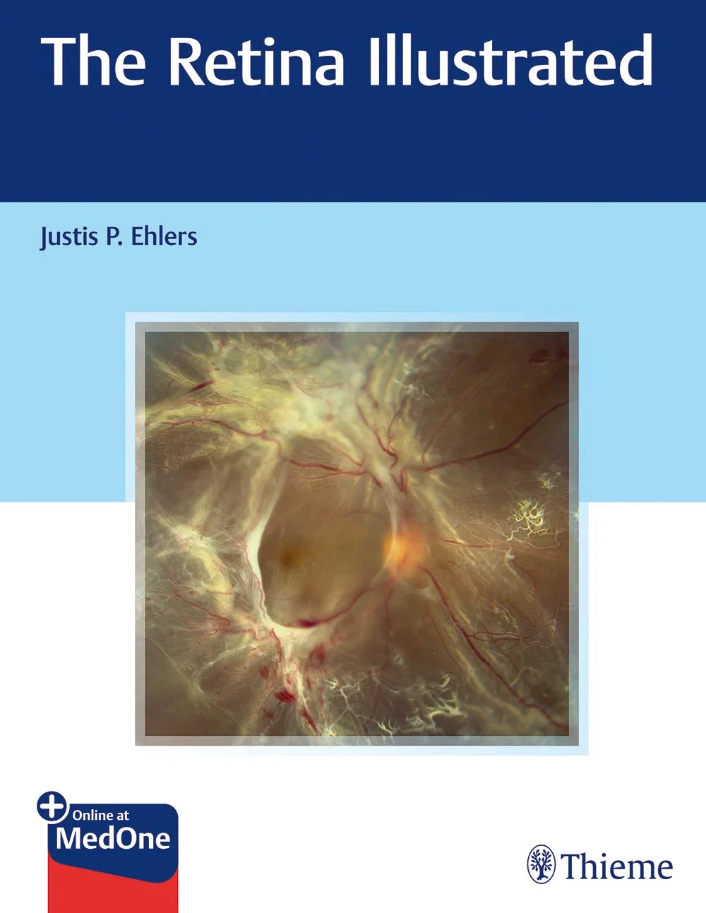 Coperta cărții "The Retina Illustrated" de Justis Ehlers