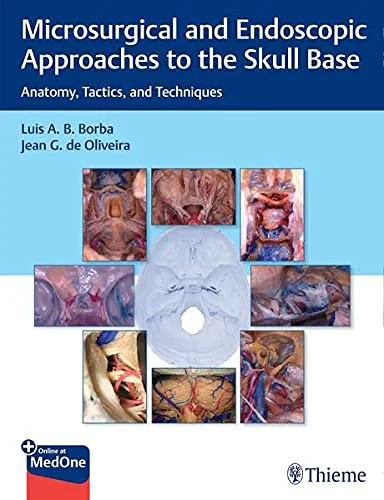Microsurgical and Endoscopic Approaches to the Sku...