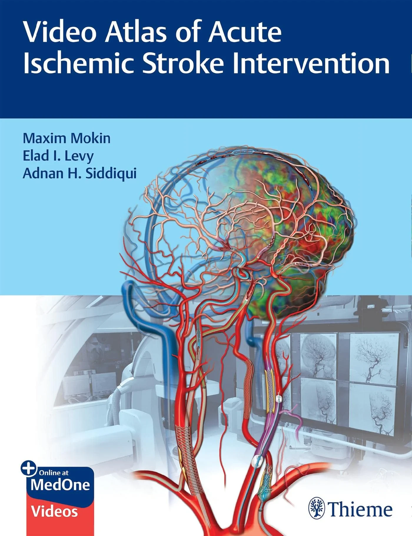 Coperta cărții "Video Atlas of Acute Ischemic Stroke Intervention" de Adnan Siddiqui, Elad Levy, Maxim Mokin