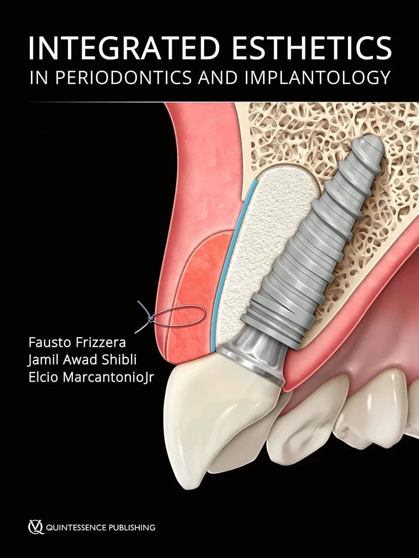 Integrated Esthetics in Periodontics and Implantol...