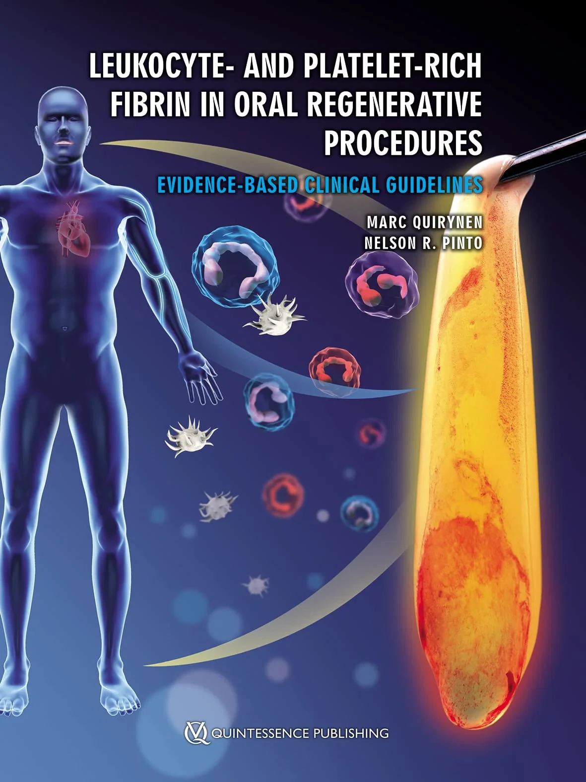 Coperta cărții "Leukocyte- and Platelet-Rich Fibrin in Oral Regenerative Procedures" de Marc Quirynen / Nelson R. Pinto