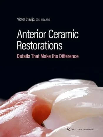Anterior Ceramic Restorations: Details That Make t...
