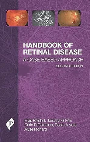 Coperta cărții "Handbook of Retinal Disease: A Case-Based Approach" de Elias Reichel, Jordana G Fein, Darin R Goldman, Robin A Vora, Alyse Richard