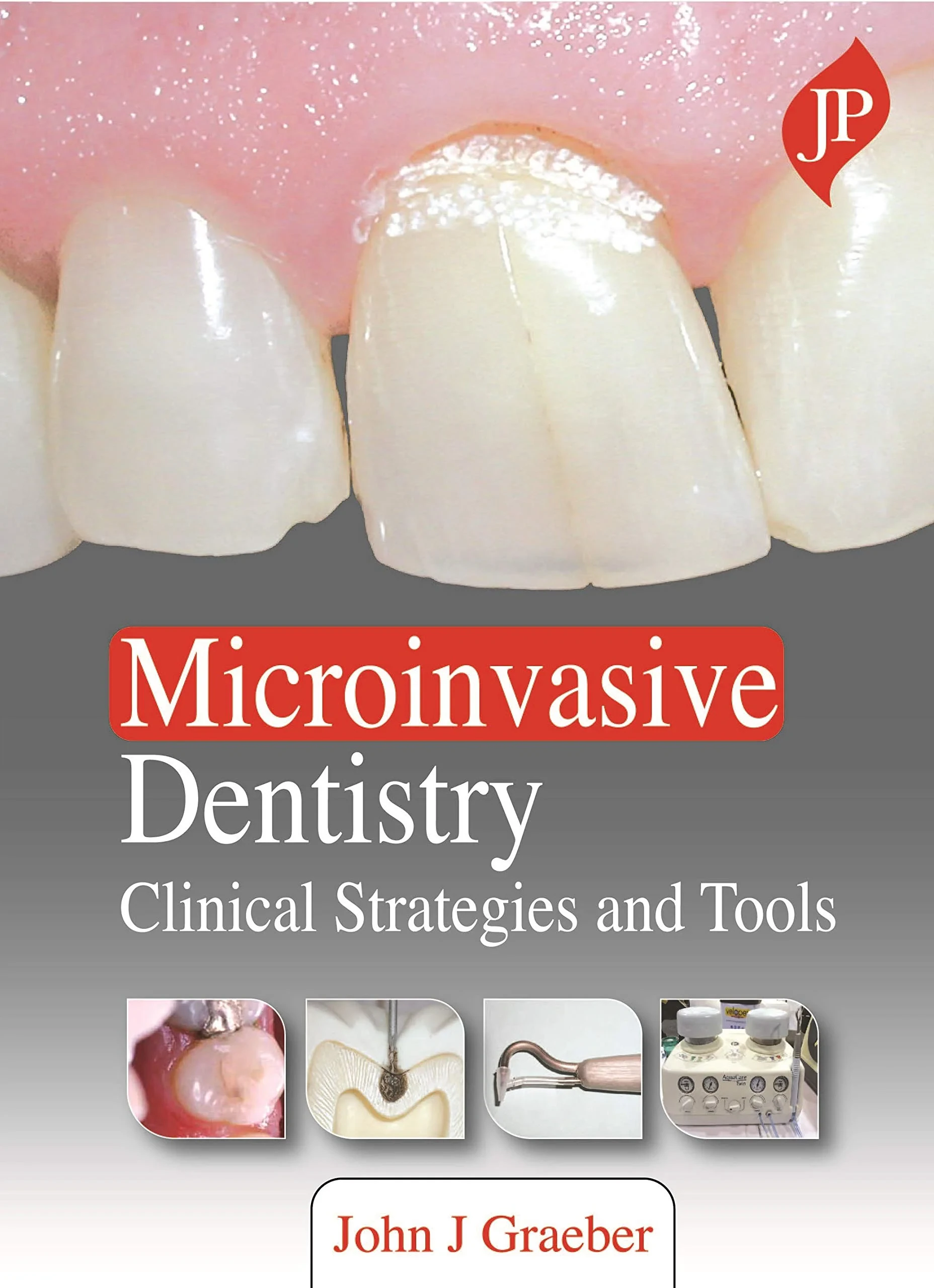 Coperta cărții "Microinvasive Dentistry: Clinical Strategies and Tools" de John J Graeber