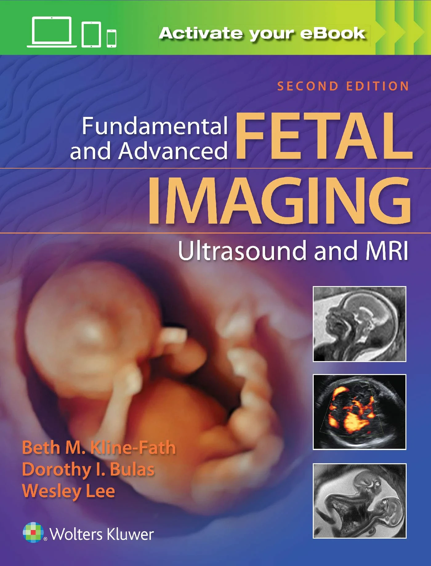 Fundamental and Advanced Fetal Imaging Ultrasound ...