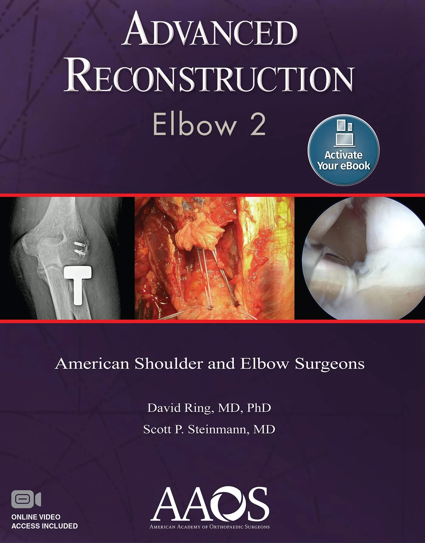 Advanced Reconstruction: Elbow 2: Print with Multi...