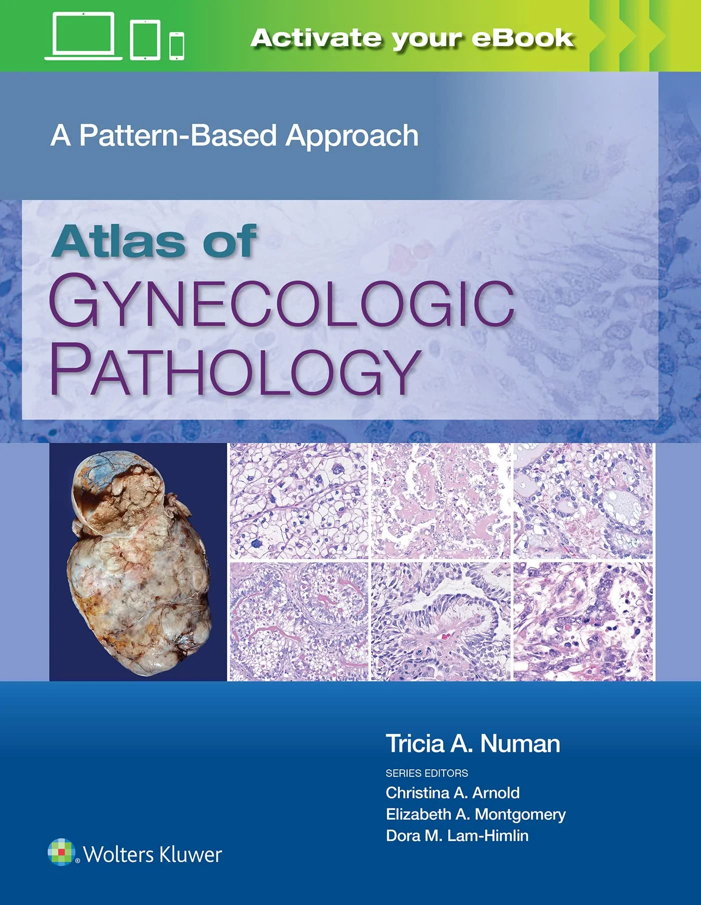 Atlas of Gynecologic Pathology: A Pattern-Based Ap...