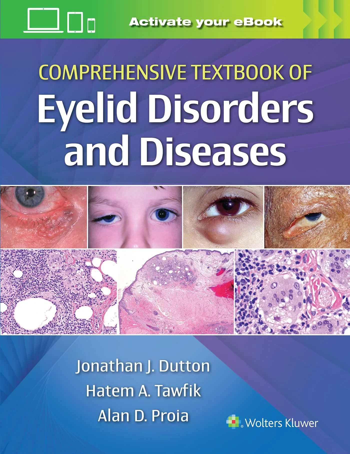 Comprehensive Textbook of Eyelid Disorders