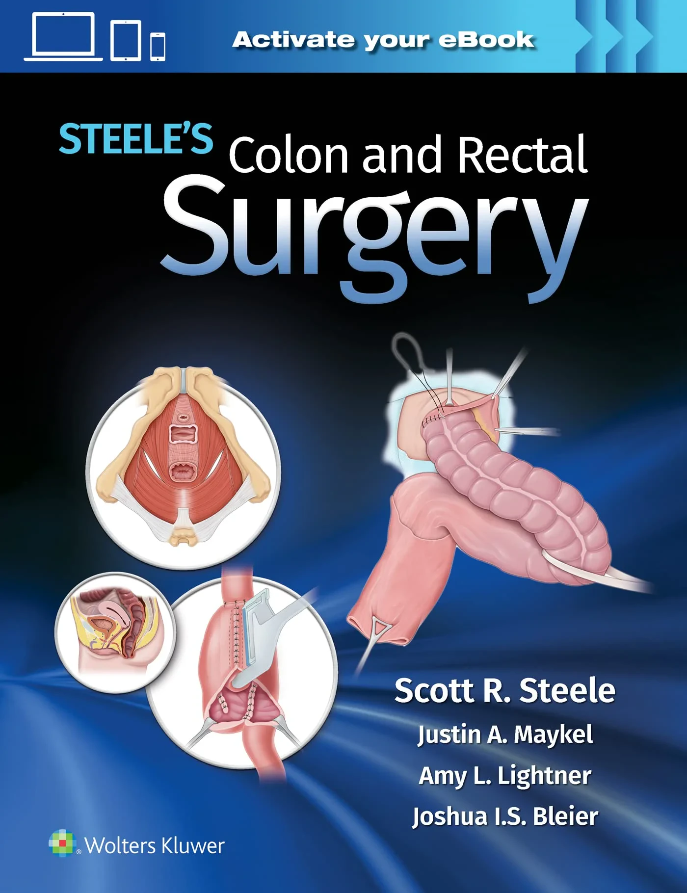 Steele's Colon and Rectal Surgery 