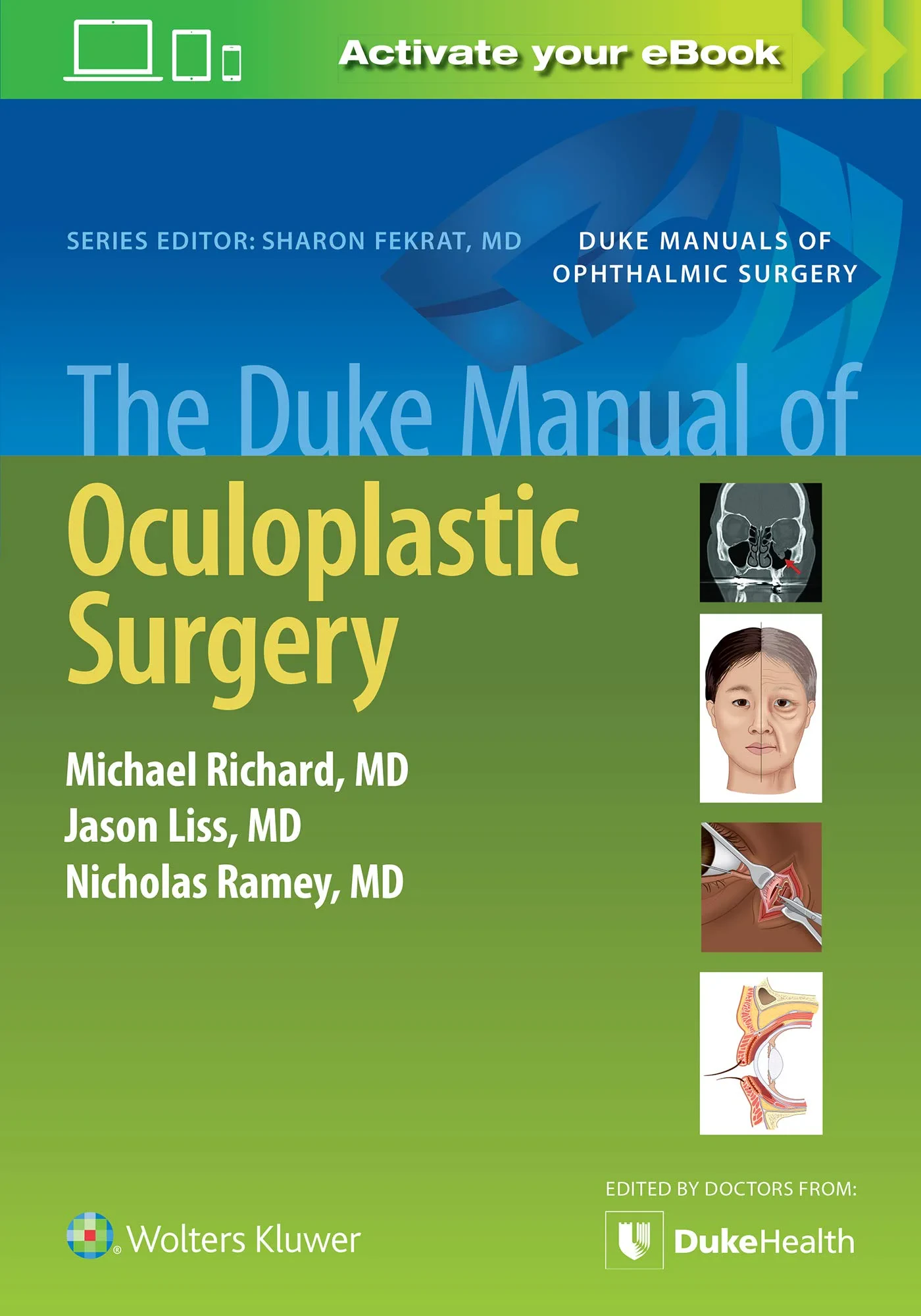 Coperta cărții "The Duke Manual of Oculoplastic Surgery " de Michael Richard, Jason Liss, Nicholas Ramey