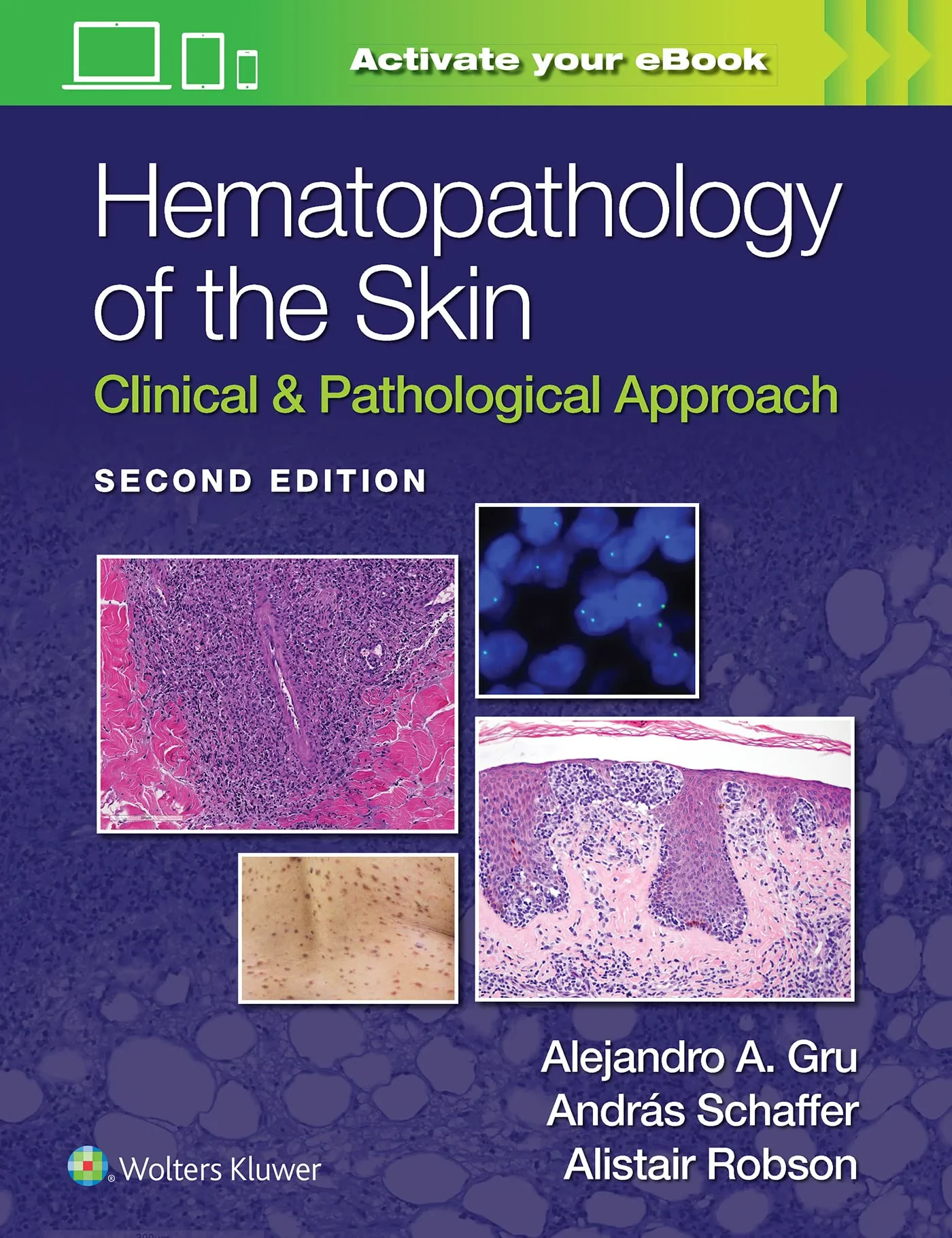 Hematopathology of the Skin: Clinical & Pathologic...