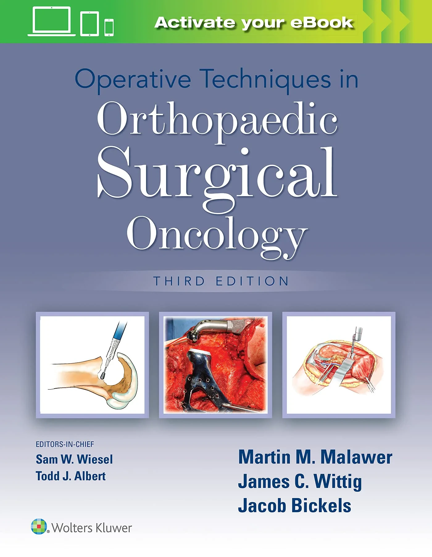 Operative Techniques in Orthopaedic Surgical Oncol...