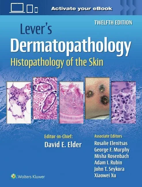 Lever’s Dermatopathology: Histopathology of the Sk...