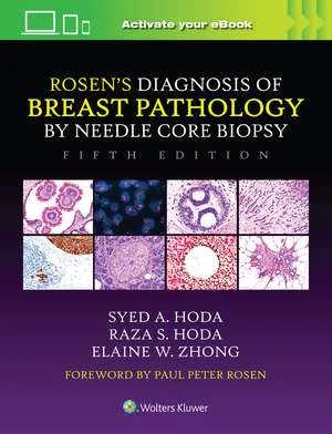 Rosen’s Diagnosis of Breast Pathology by Needle Co...