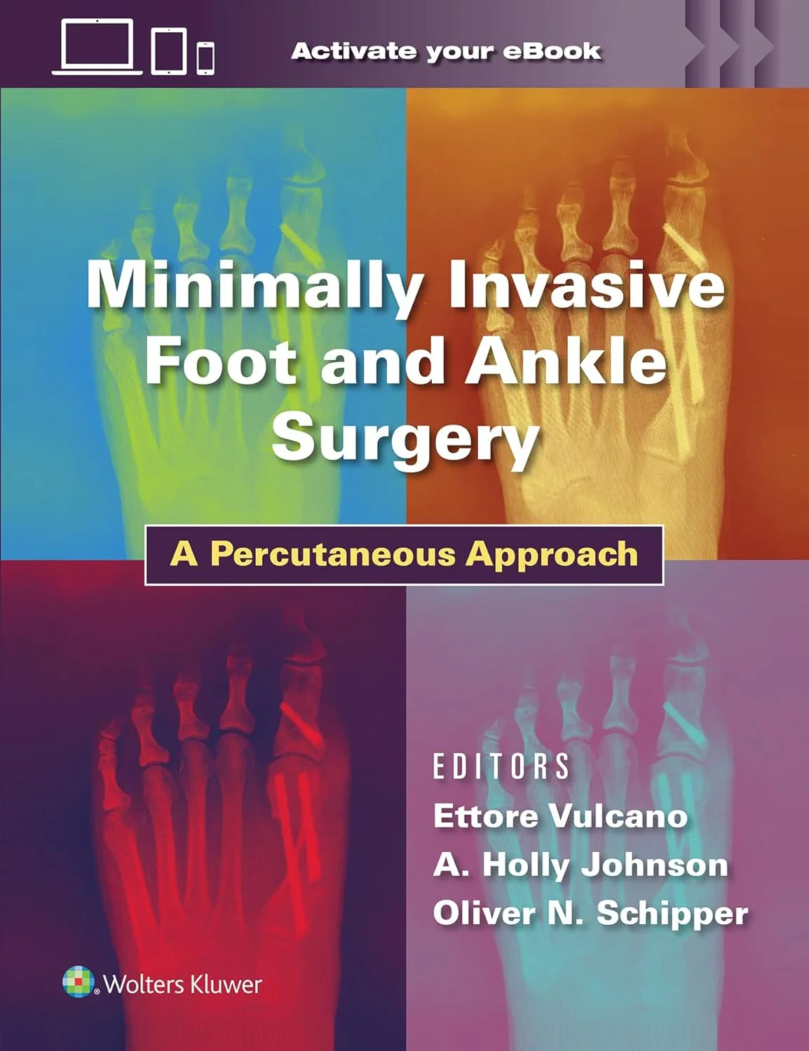 Coperta cărții "Minimally Invasive Foot and Ankle Surgery: A Percutaneous Approach" de Dr. Ettore Vulcano MD, A. Holland Johnson MD, Oliver Schipper