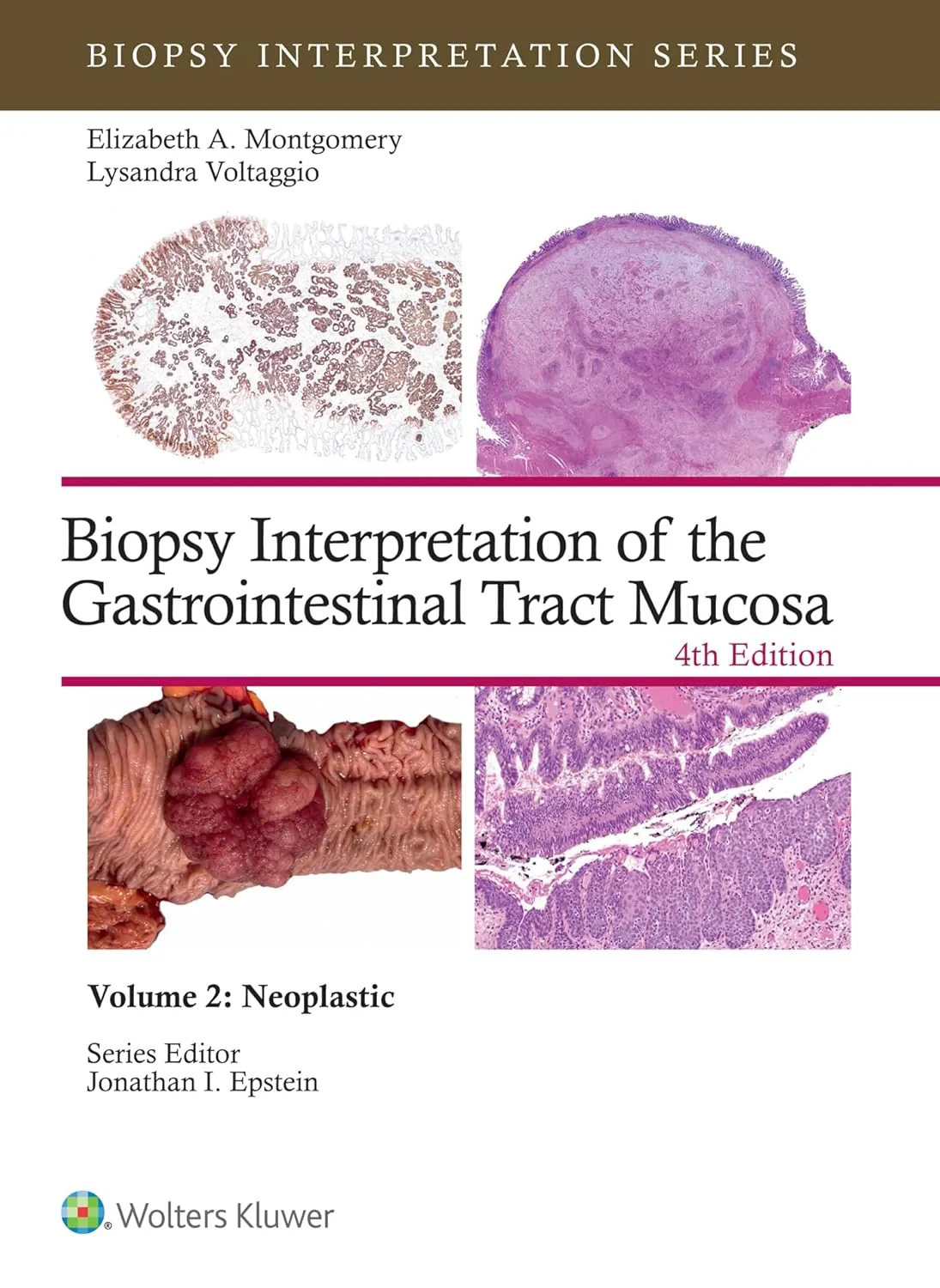 Biopsy Interpretation of the Gastrointestinal Trac...