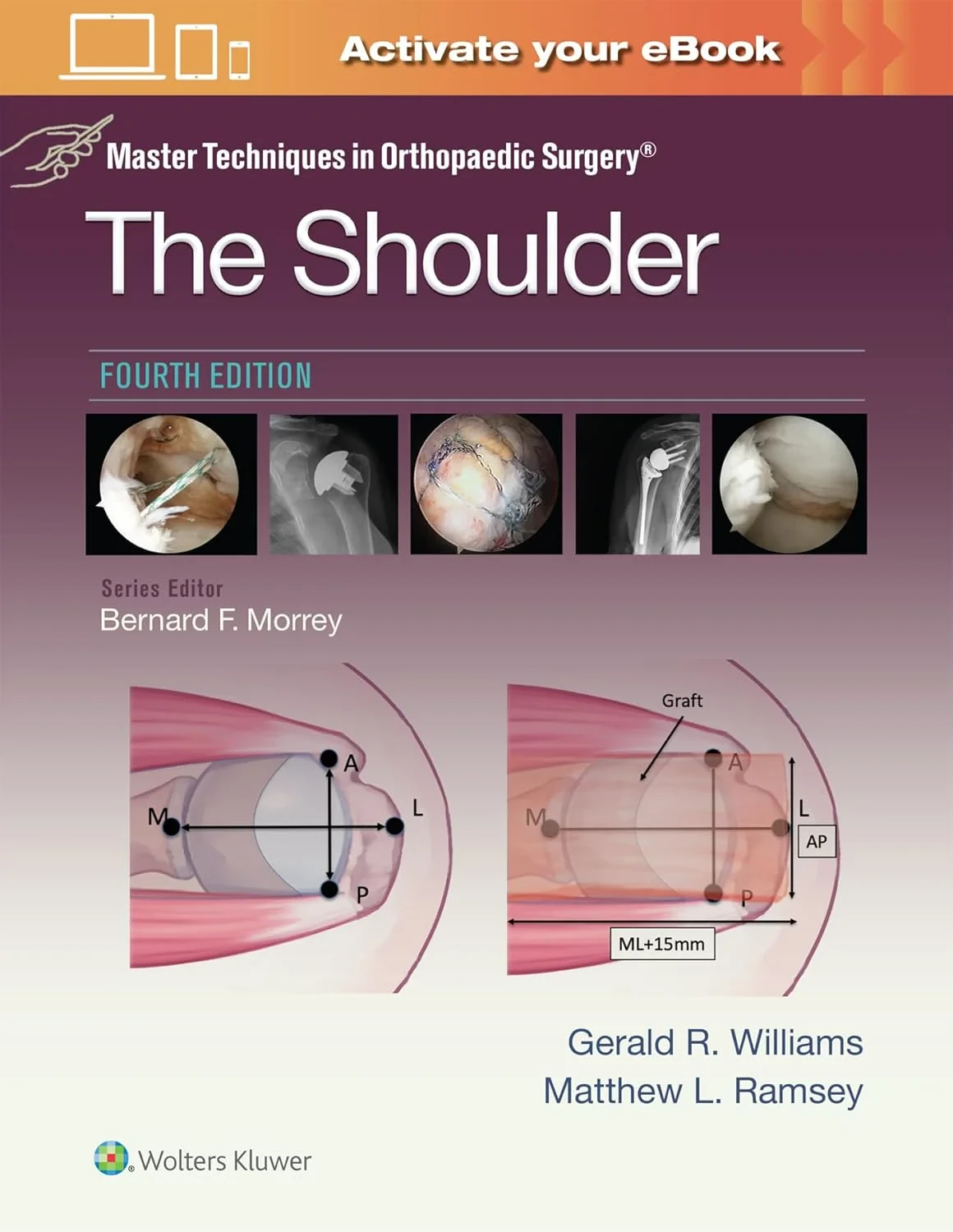 Master Techniques in Orthopaedic Surgery