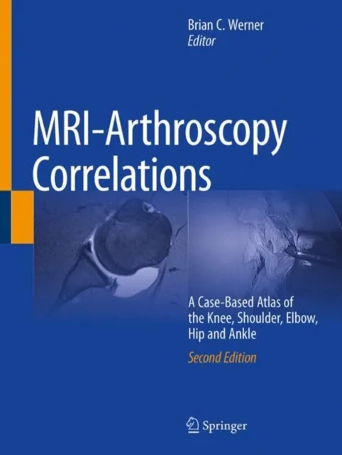 MRI-Arthroscopy Correlations