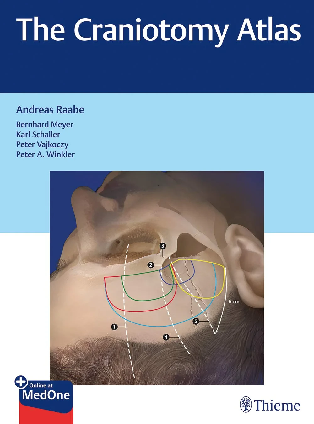 Coperta cărții "The Craniotomy Atlas" de Andreas Raabe