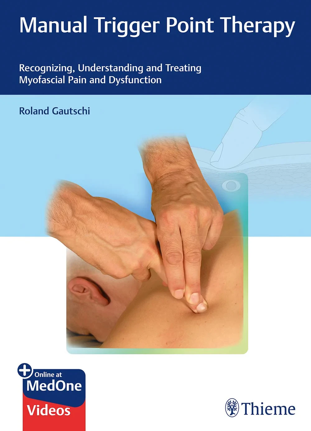 Coperta cărții "Manual Trigger Point Therapy" de Roland Gautschi