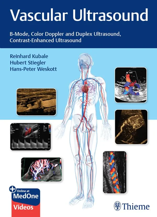 Vascular Ultrasound – B–Mode, Color Doppler and Du...
