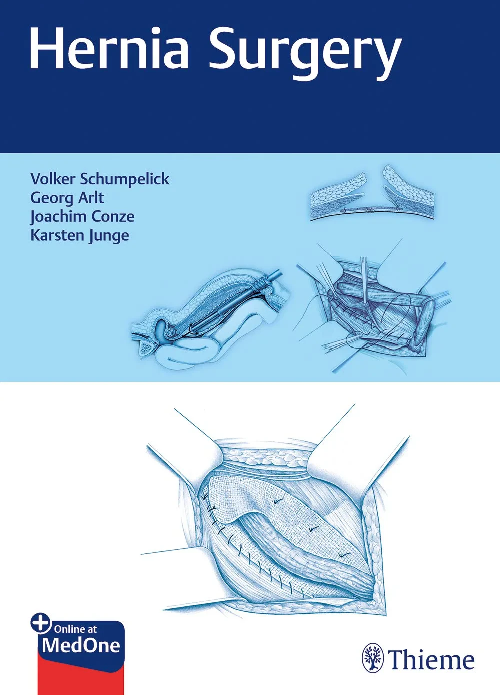 Coperta cărții "Hernia Surgery" de Volker Schumpelick, Georg Arlt