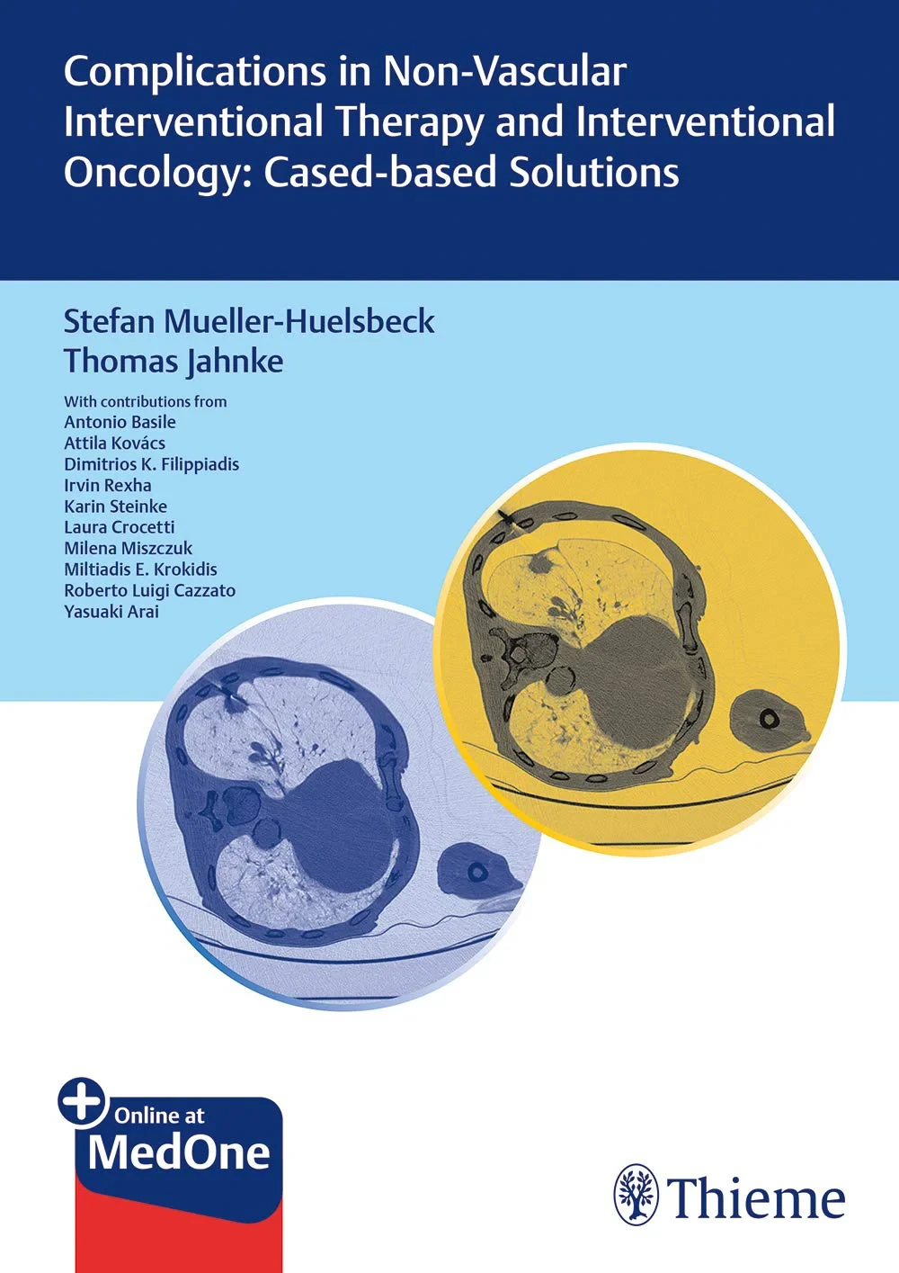 Coperta cărții "Complications in Non-vascular Interventional Therapy and Interventional Oncology: Case-based Solutions" de Mueller-Huelsbeck; Jahnke, Mueller-Huelsbeck, Jahnke