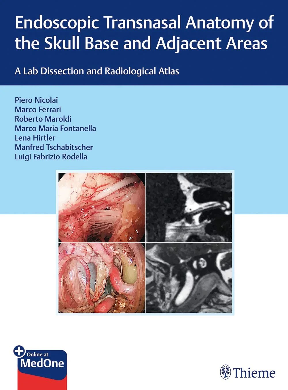 Endoscopic Transnasal Anatomy of the Skull Base an...
