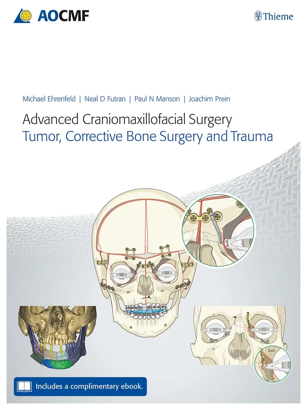Advanced Craniomaxillofacial Surgery: Tumor, Corre...