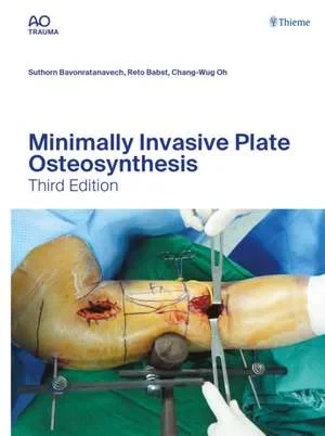 Minimally Invasive Plate Osteosynthesis