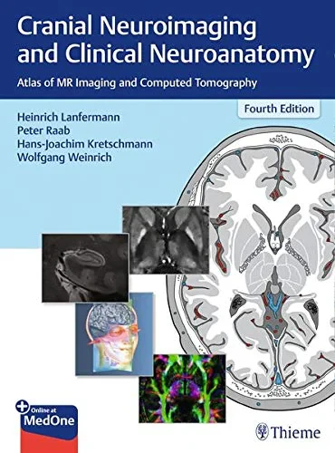 Cranial Neuroimaging and Clinical Neuroanatomy: At...