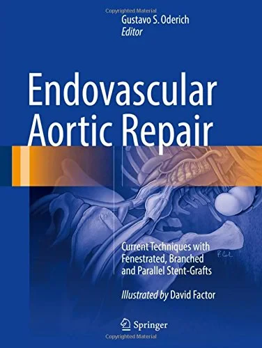 Endovascular Aortic Repair: Current Techniques wit...
