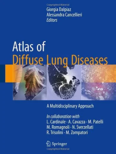 Coperta cărții "Atlas of Diffuse Lung Diseases" de Giorgia Dalpiaz, Alessandra Cancellier