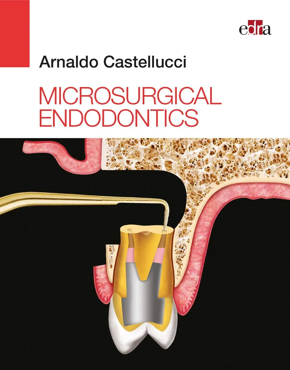 Coperta cărții "Microsurgical Endodontics " de Arnaldo Castellucci Elio Berruti