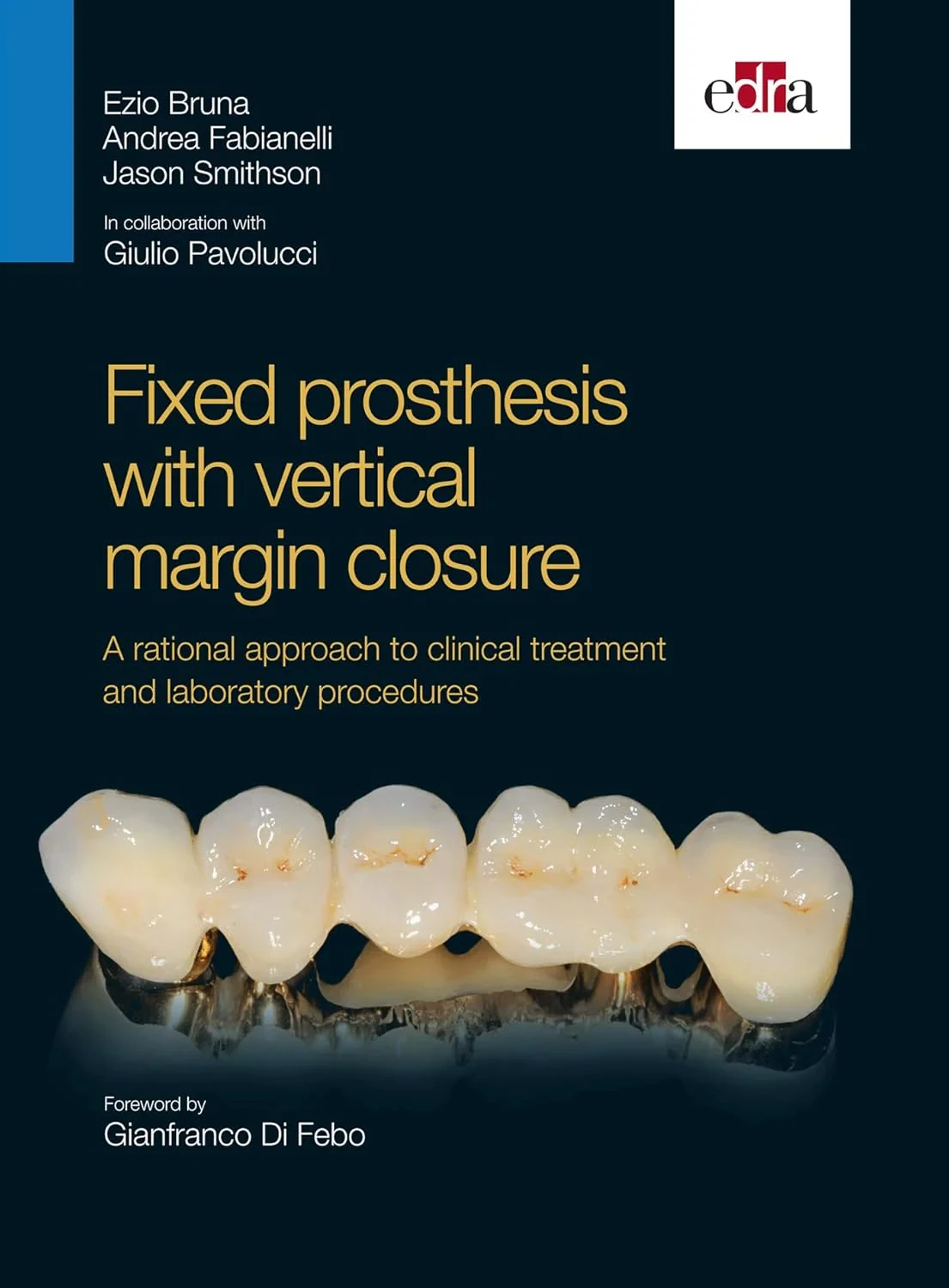 Coperta cărții "Fixed prosthesis with vertical margin closure" de Andrea Fabianelli Ezio Bruna Jason Smithson