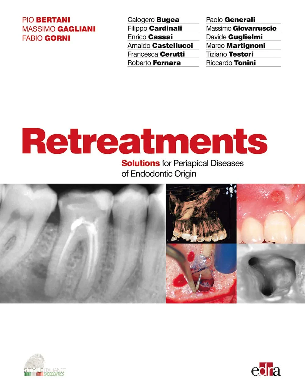Coperta cărții "Retreatment - Solutions for periapical diseases of endodontic origin" de Fabio Gorni Massimo Gagliani Pio Bertani