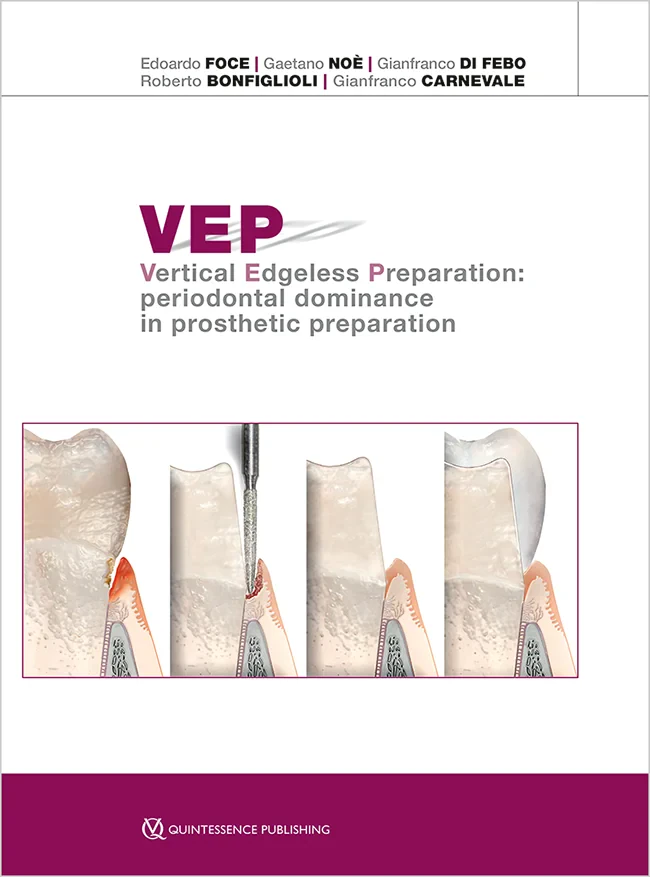 Coperta cărții "VEP Vertical Edgeless Preparation" de Edoardo Foce / Gaetano Noè / Gianfranco Di Febo / Roberto Bonfiglioli / Gianfranco Carnevale