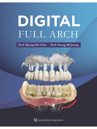 Digital Full Arch