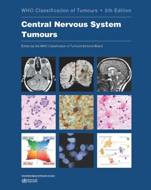 Central Nervous System Tumours: Who Classification...