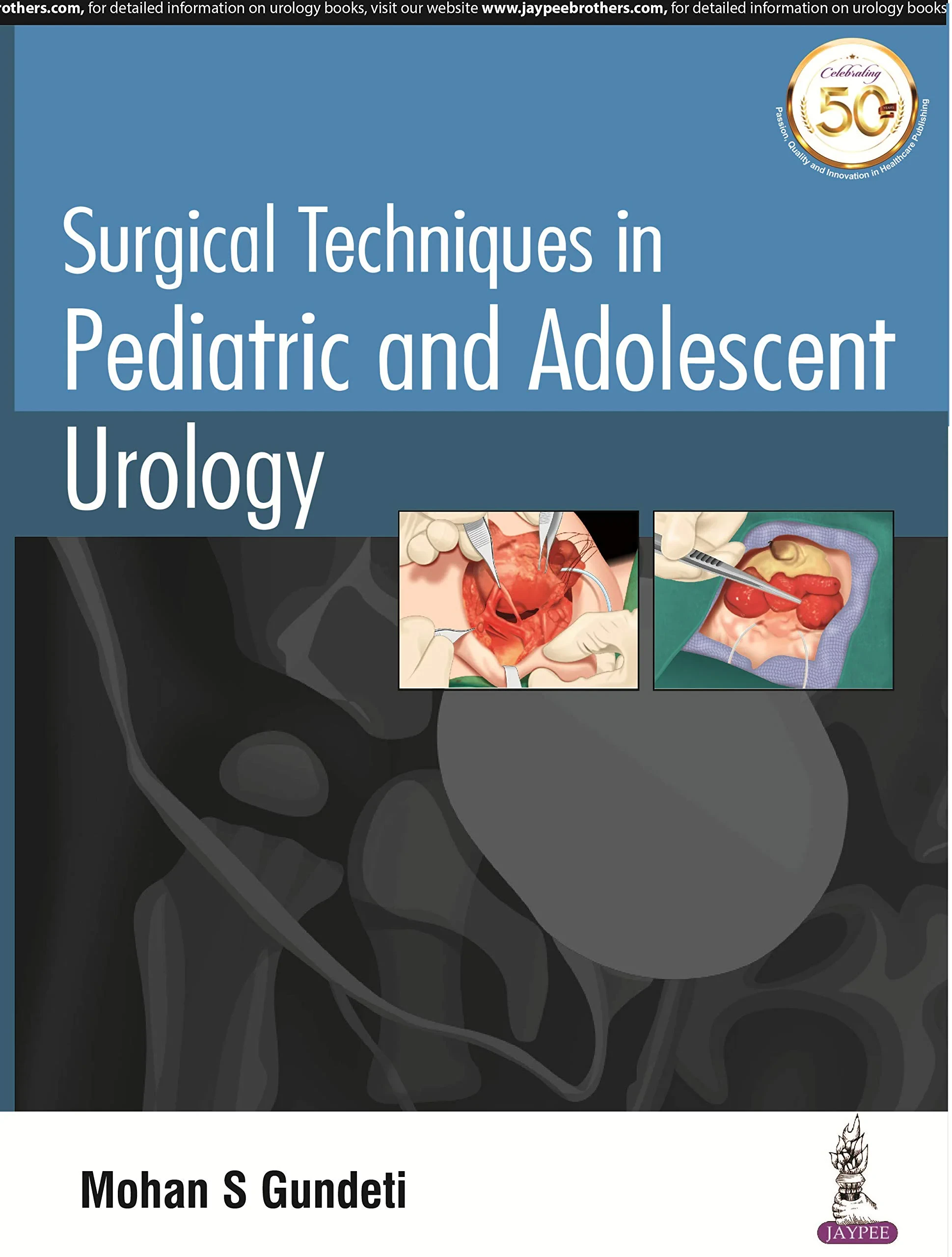 Surgical Techniques in Pediatric and Adolescent Ur...
