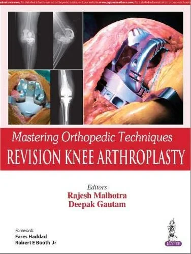 Mastering Orthopedic Techniques: Revision Knee Art...