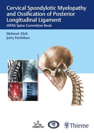 Coperta cărții "Cervical Spondylotic Myelopathy and Ossification" de Mehmet Zileli, J.k.b.c. Parthiban