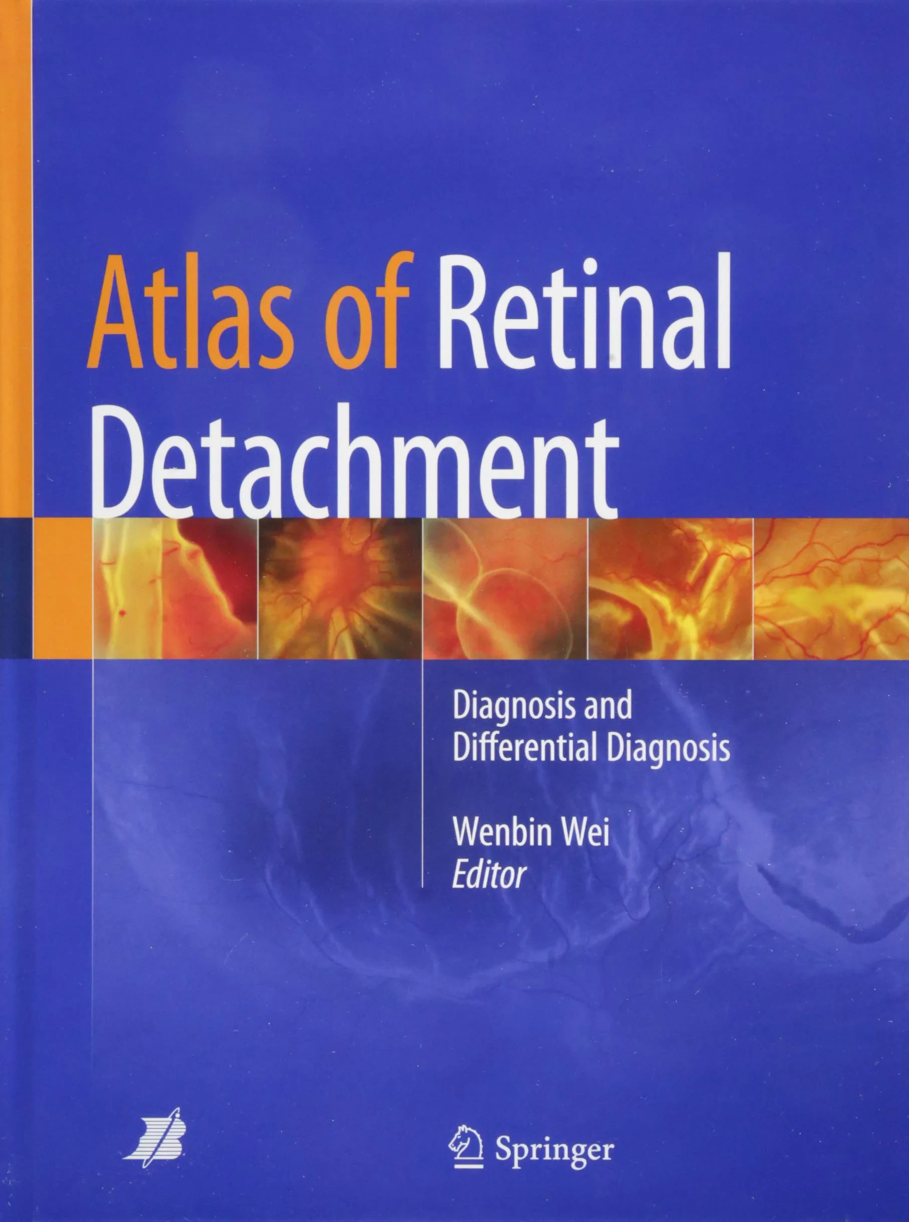 Atlas of Retinal Detachment: Diagnosis and Differe...