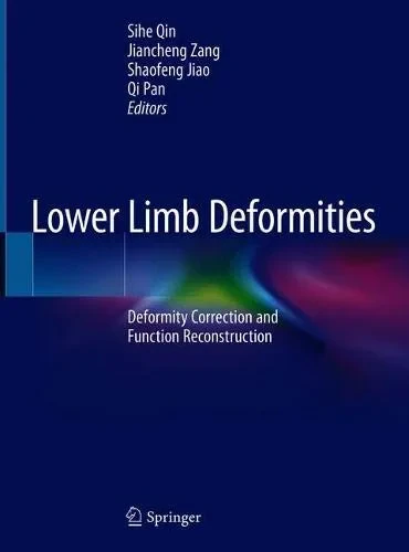 Lower Limb Deformities: Deformity Correction and F...